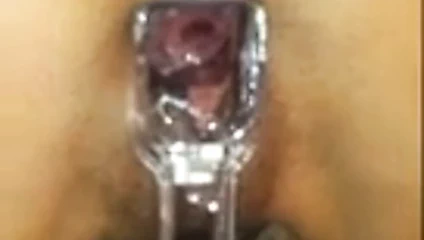 Derin gözlem için onun önünü spekulum ile speeding