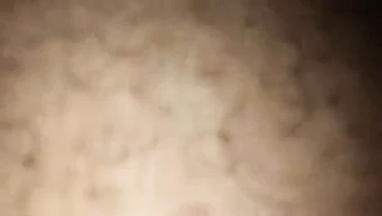 Kıllı amcık