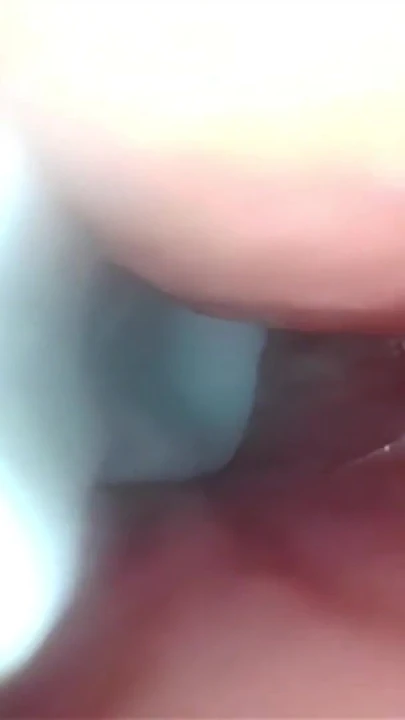 Serviks geniş esneyen amcık endoskopunda sperm! | Klip 1