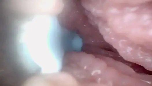 Sulu amcığıma birlikte bir göz atalım (endoskop kamerası)