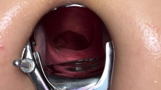 24.01.2024 şenlikli hotkinkyjo - anal, gape, göğüsler, göt, spekulum, anal spekulum, aşırı sokmalar, sokmalar