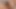 Hairy Exotic PYT