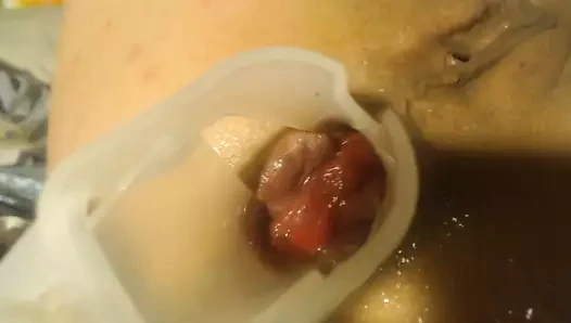 Anal spekulum ve gösteri içeride benim göt bölüm 2