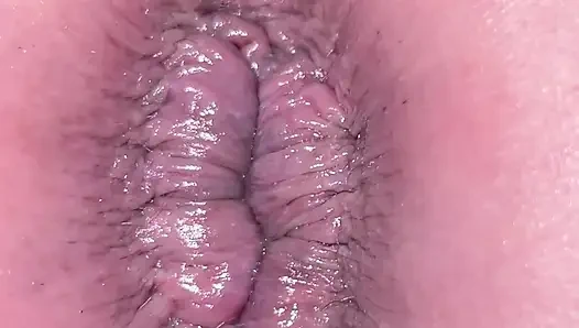 Delik genişletme yakın çekim