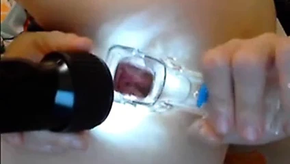 anal spekulum ile webcam Rus kız