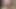 Abgebundene Titten und lange Nippel 2