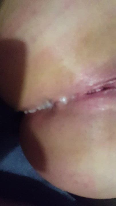 anal anal