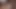 Minyon seksi hemşirenin ağzı, amcığı ve götü demir yatakta sikiliyor