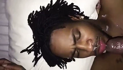 Yüzündeki fındık