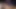 Mylked - genç rachel nehirleri cumshot giyen diş telleri