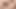 Boşalma öncesi mikro penis