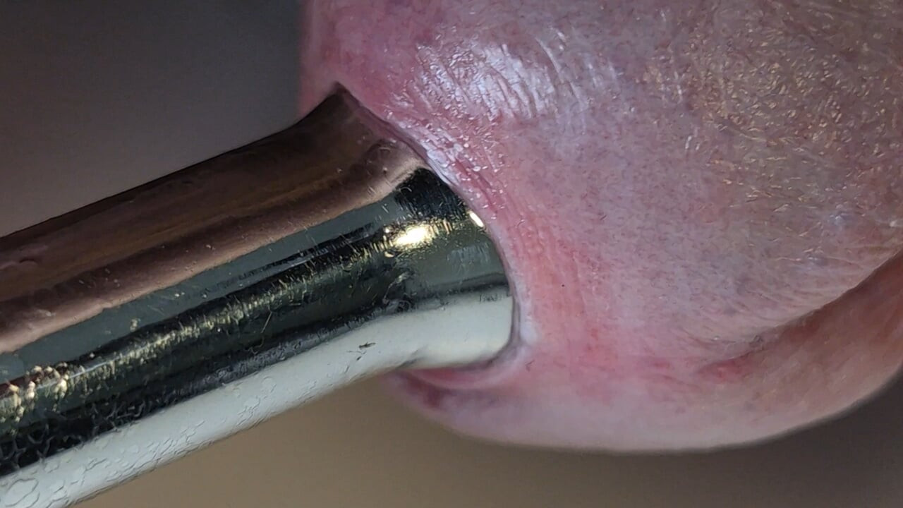 Son derece sıkı 14 mm üretral gözyaşı tıkacı yakın çekim.