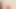 Anal esnetme