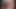 KB-Nylon