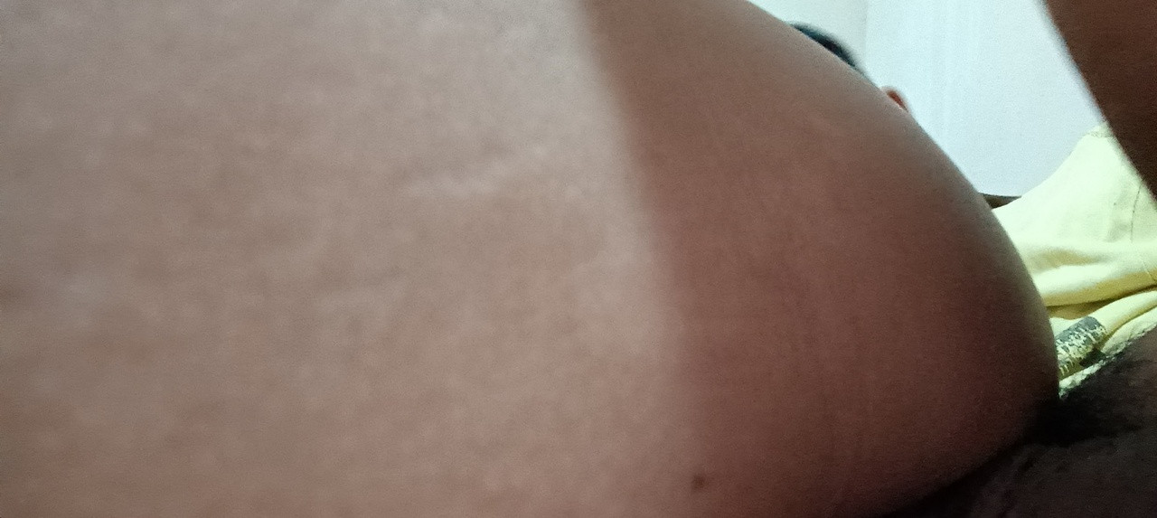 anal 1