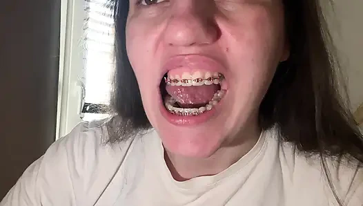 Dilinizle diş teli yalamak