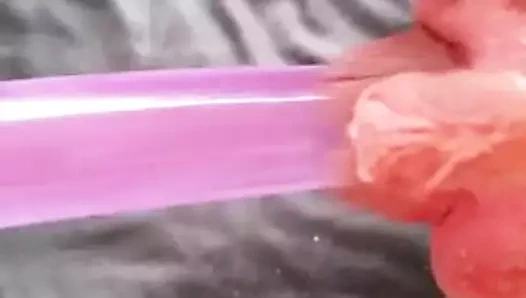 Büyük klitoris ve labia