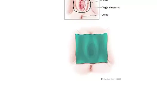 How to Use a Dental Dam