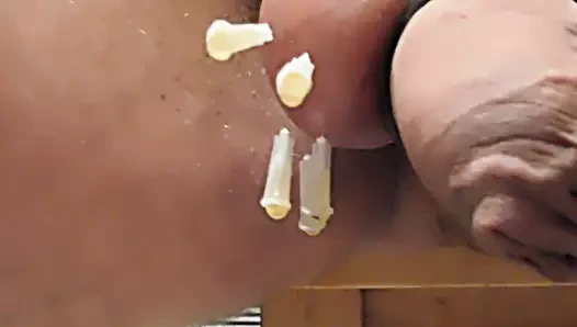 Toplarımdaki iğneler