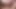 anal