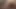onun oyun teaser