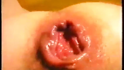 mükemmel vintage anal prolapsus