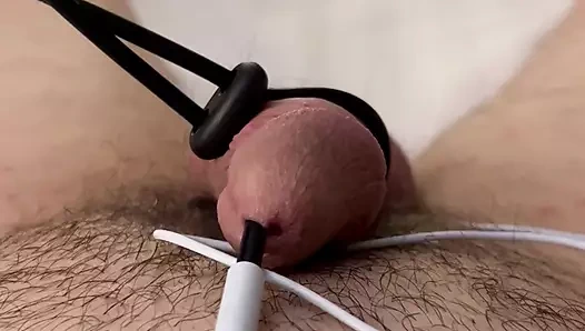 Prostatımı yarak elektrotla şok ediyor