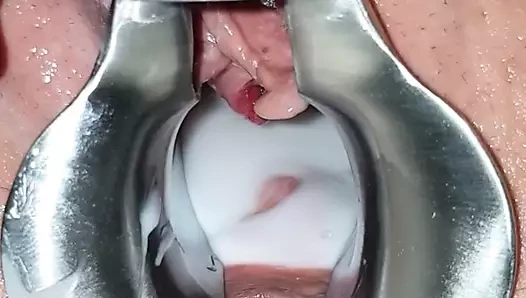 Karımın cesareti dolu spekulumu kedi yaymak