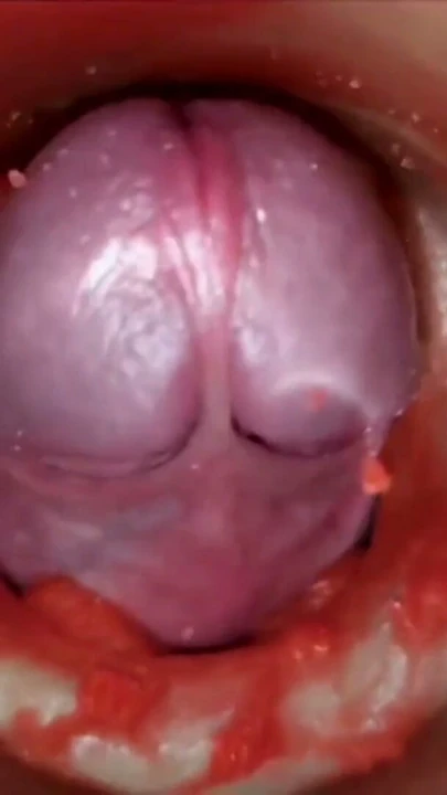 Cumfeti Damlayan Creampie Derlemesi - Endoskopi Görünümü | Bölüm 1