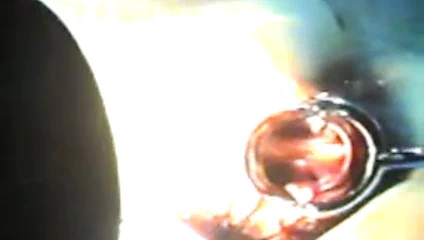 (107)zhangjiajing hemşireler tayvan