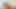 Annabel-Massina: User spritzt 2x