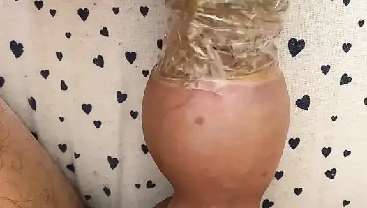 Sünnete aşırı pompalama