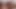 Bana pov darbe - kaba öğürme bjs