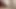 Kalın Penis Erkek Ve Creampie Ile Anal