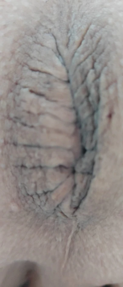 anal plug