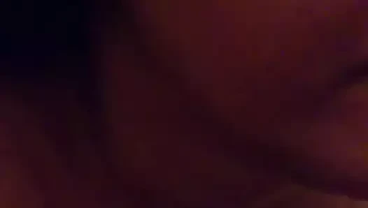 Yırtık noktası ve yüz obkonchal