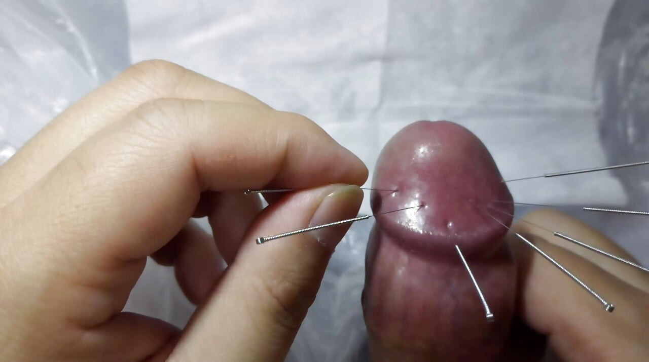 TCMB iğneleme penis