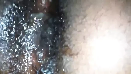 Kıllı anal