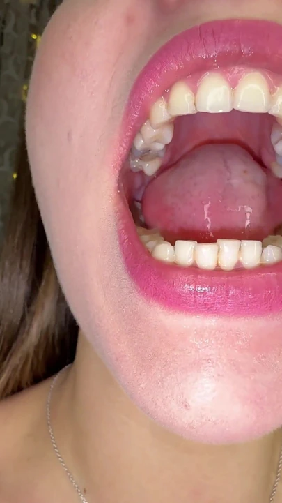 Ağız sırları: dilimde kalın beyaz kaplama