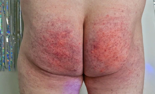 Dominatrix Nika köleyi kırmızıya dönene kadar çıplak götüne şaplak atarak cezalandırıyor. Kadın egemenliği bdsm şaplak