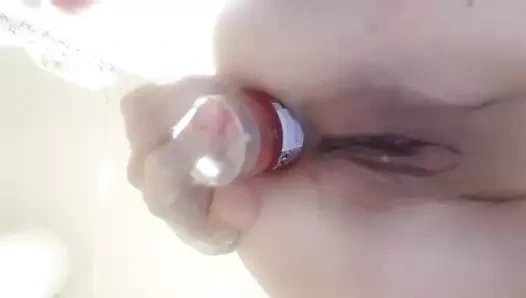 Üretra ve göt sarkması