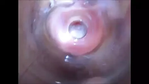 Vajinal meyve suyunun kaynağını gözlemledim