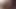 Married Slut Bleaches All Her Body Hair and Gets Completely Naked in the Backyard for Everyone to See