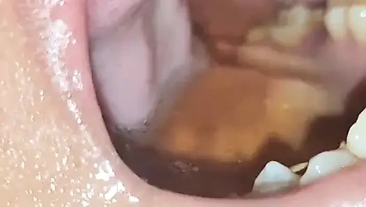 Kölem örümcek adamı taklit etti ve süt gırtlağına kadar baş aşağı durdu