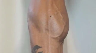 Fbb esneme ona dev kasları