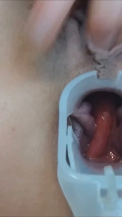 Speculum götümde yakından ve amımla oynuyorum ıslak zonklayan orgazmlar | Bölüm 2