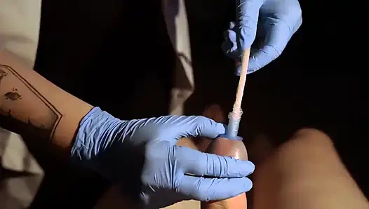 Bakış açısı hasta. Bir Sonda Sesi Çıkarıyor ve Yerleştiriyor