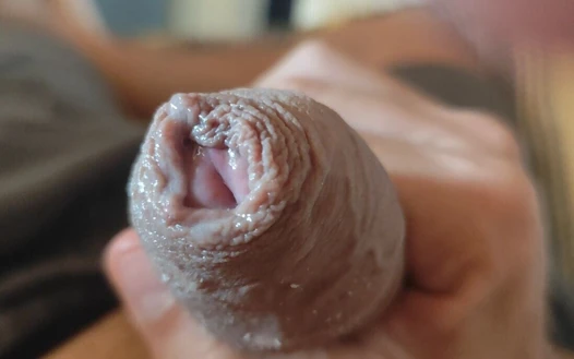 Great Phimosis Getting in the Way of the Boy's Orgasm