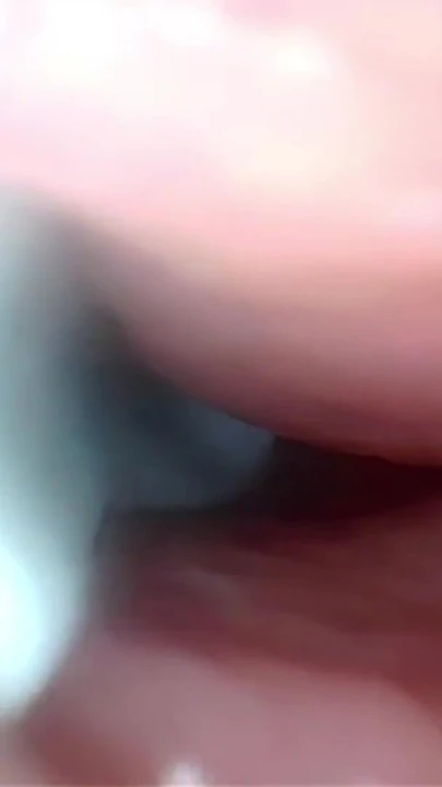 Serviks geniş esneyen amcık endoskopunda sperm! | Klip 1