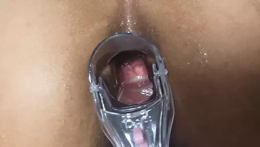 anüsümdeki spekulum